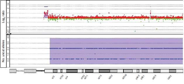 UPD ολόκληρου χρωμοσώματος 15 HYBRID CNV+SNP