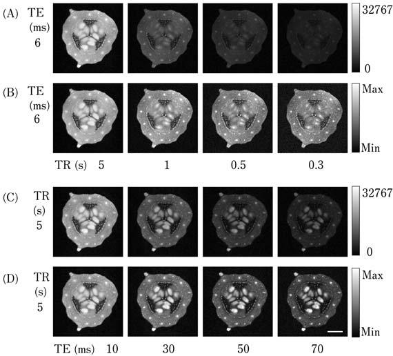 31 : MRI 149 Fig.