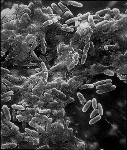 Λοιμώξεις ξένων σωμάτων και Δαπτομυκίνη Ταχύτερη εκρίζωση MRSA μέσα από biofilm καθετήρων και μοσχευμάτων