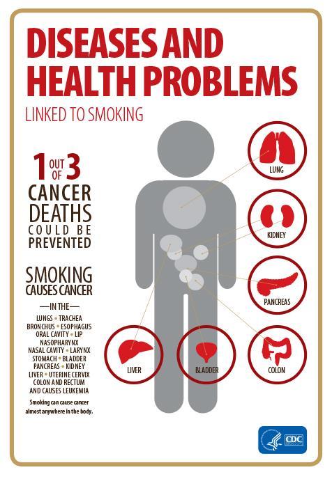 Κάπνισμα οι καπνιστές έχουν 20 φορές περισσότερες πιθανότητες ανάπτυξης καρκίνου πνεύμονα από ότι