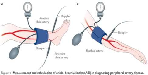 (ABI Collaboration, JAMA 2008) (ESC/ESH Guidelines 2018) 1 ης γραμμής μη επεμβατικό test για screening