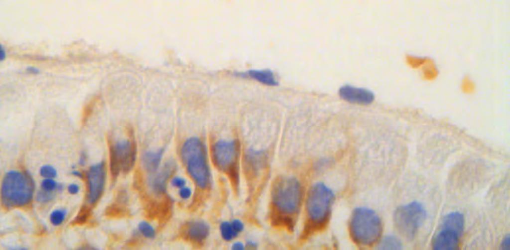 Εικόνα 33. Ανοσοχρώση επιτόπου Η. Μεγαλύτερη μεγέθυνση της εικόνας 31. Βλεννοπαραγωγά κύτταρα με έντονη υποπυρηνική κυτταροπλασματική χρώση (βέλος).