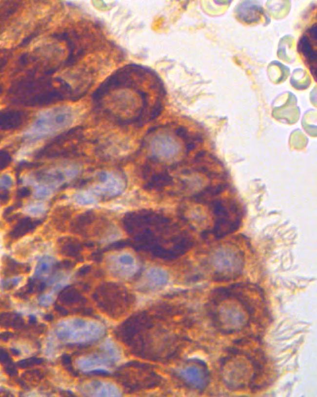 Ανενεργοί ινοβλάστες (ινοκύτταρα) αρνητικοί (αστερίσκος). Μεγέθυνση: x630. Εικόνα 6.
