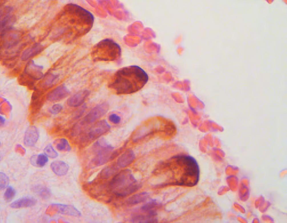 Εικόνα 15. Ανοσοχρώση για κερατίνη 8. Βλεννοπαραγωγά κύτταρα με δικτυωτή χρώση.