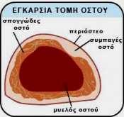 Η δοµή των οστών Β. Κάθε οστό καλύπτεται εξωτερικά από µια µεµβράνη που ονοµάζεται περιόστεο: 1.