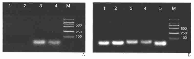 04 3 50, PBS 2, : 400, 1 000 g 3 min,, (0125 %) 37 10 min 488 nm,, 1 000 g 5 min, 10 % DMEM 1 ml, 6,, 37 5 % CO 2 CO 2 ( %) = ( / ) 113 sirna Lipofectamine TM 2000 ( Invit2 rogen) : 250 l 4 g, 2 250