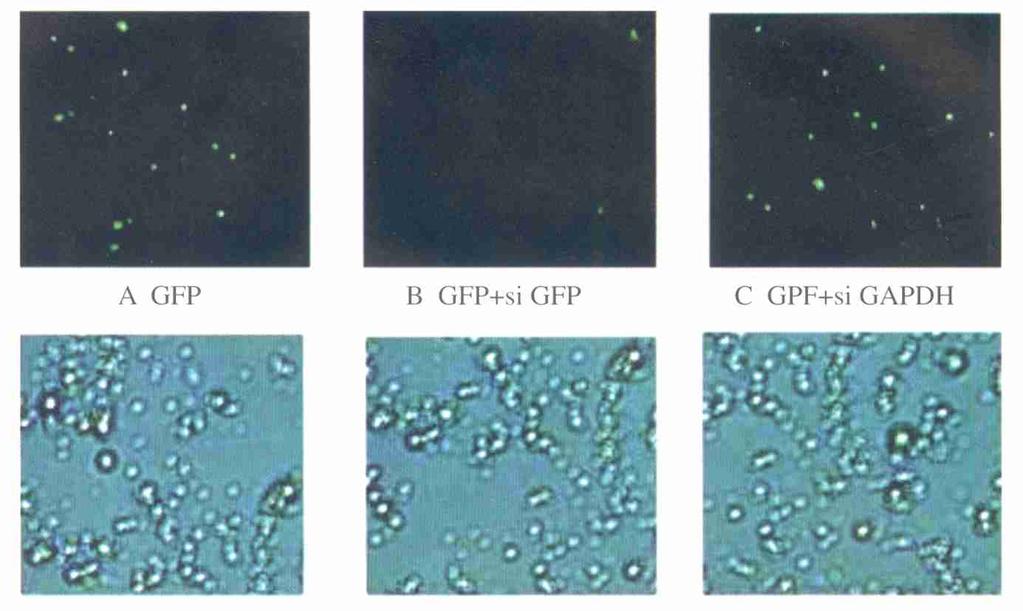 2 : RNA 305 2 sirna A. p EGFP2C1 B. p EGFP2C1 si GFP C.