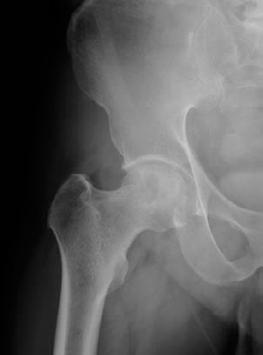 . / 66 A B C D 2 25 X Figure 2 X-ray films