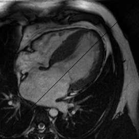 HCM