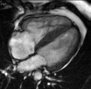 Cardiac