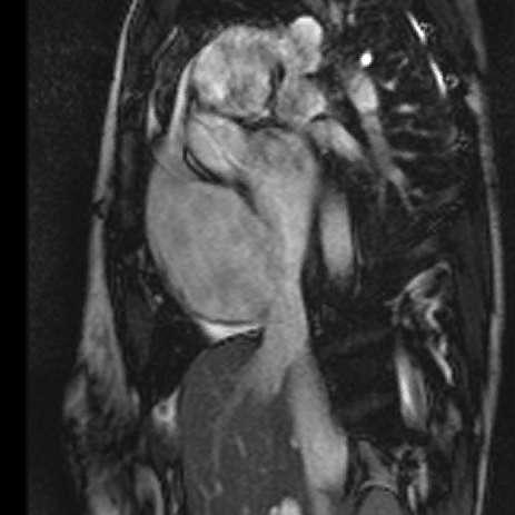 Congenital