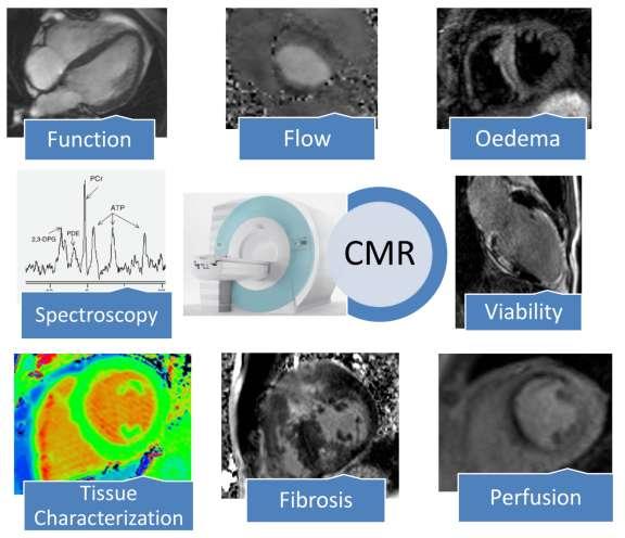 CMR: a powerful tool in Cardiology