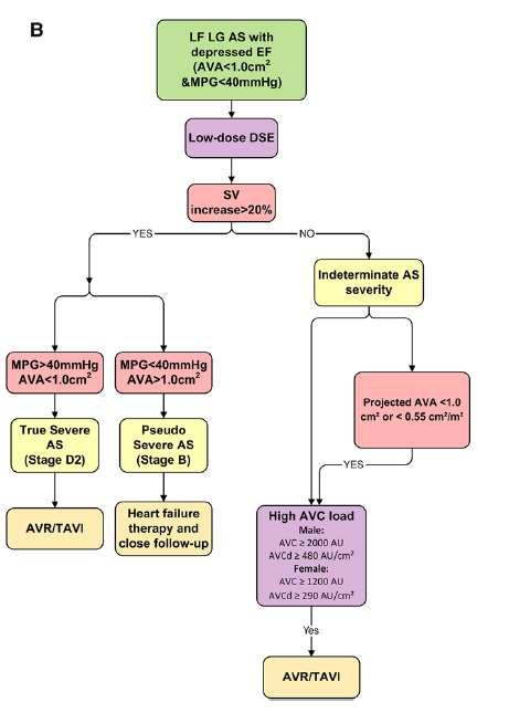 Αλγόριθμος για ασθενείς με ΑΣ και μειωμένο κλάσμα εξώθησης Heart Valve