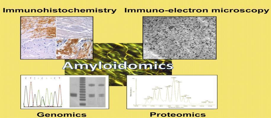 Apple-green birefringence of fibrillar protein deposits is the sine qua non of amyloidosis To type amyloid fibrils and guide appropriate therapeutic decision-making, a variety of specialized