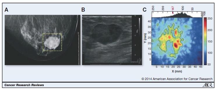 Reviews, 2014 X-Ray CT Ultrasound