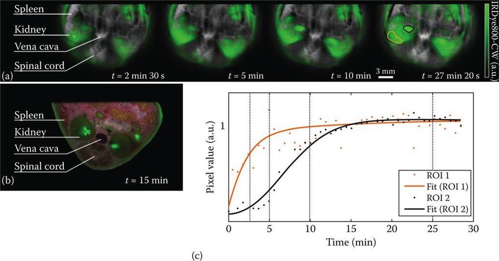 In-vivo απεικόνιση φιλτραρίσματος των νεφρών μέσω πολυφασματικής φωτοακουστικής τομογραφίας σε ποντίκια Αιμοσφαιρίνη
