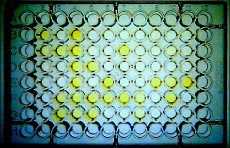 Ταυτοποίηση του ιού (3) Ανοσοενζυμική δοκιμή άμεσης διπλής παρεμβολής (DAS-ELISA) για την ανίχνευση του PeMV (οι κυψελίδες με κίτρινο χρώμα