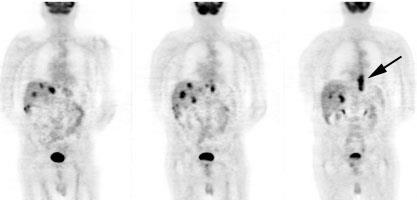 com/pet_pancreas_coronal_sund.