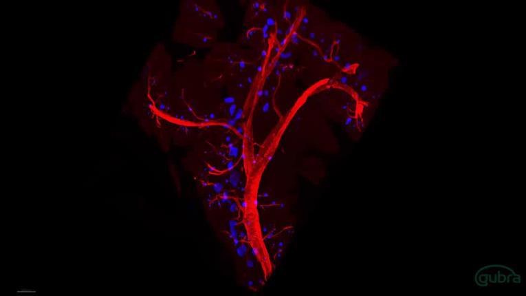 v=gheixbknmwc A normal adult mouse kidney stained for Podocin 1 (blue)