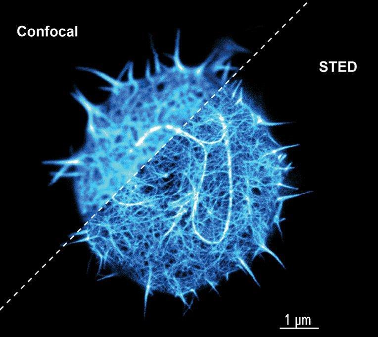 2-color 2D STED image of a cleared adult kidney sample of a rat Shown is an image of a