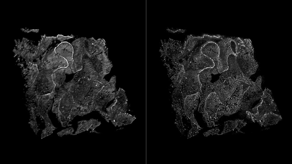 Deep nanoscopy 45-65 µm inside cleared adult kidney sample of a rat.