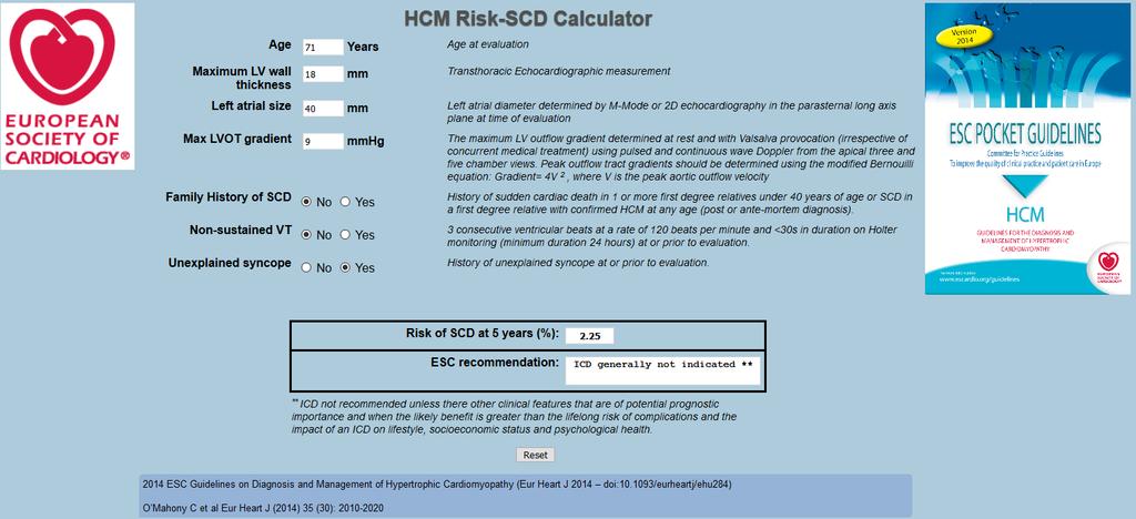 Consider HCM?