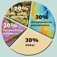 Παθογόνοι Μικροοργανισμοί Μικρόβια: a-hemolytic Streptococcus S. aureus S.pneumoniae H.