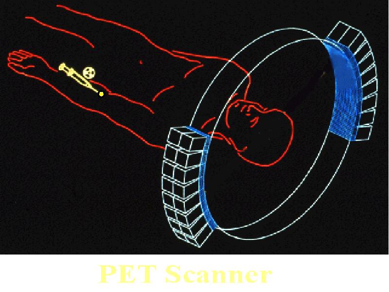 P.E.T