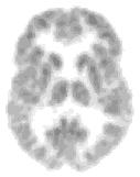 Important Detector Properties - Energy resolution - Scattered gammas change direction AND lose energy - Affects acceptance of