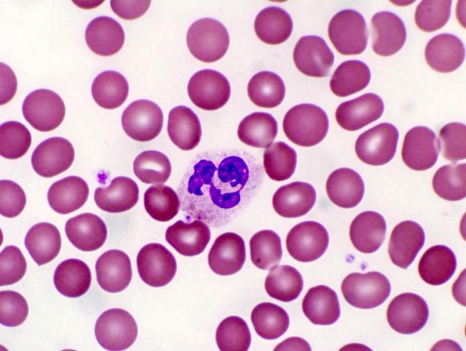 Blood smear showing a neutrophil circulating within the blood stream (www.quia.com). Under normal circumstances, neutrophils circulate within the blood stream waiting to be called into action [4-7].