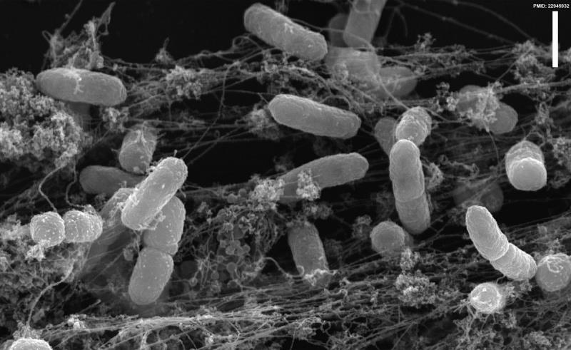 1.6. NETs, a key mechanism of neutrophils As mentioned above, generation and release of neutrophil extracellular traps, a process commonly termed NETosis, is one of the main strategies that