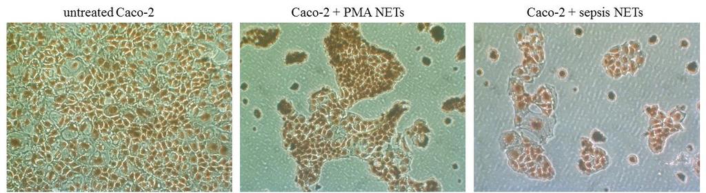 Figure 1. Verification and quantification of in vitro generated NETs. NET release was depicted as % formation of MPO/DNA complex.