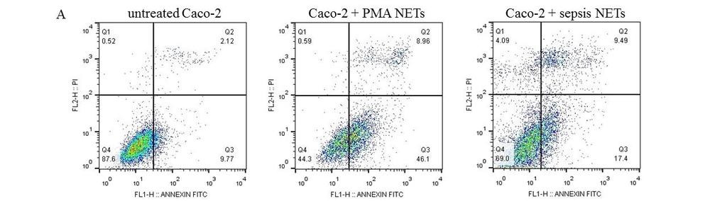 We next investigated whether NETs inhibit Caco-2 growth via apoptosis.
