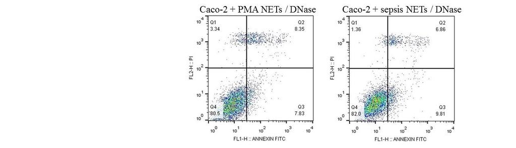 5A-B). DNase I attenuated this effect on apoptosis (Figures 5A- B). Moreover, apoptosis induction by NETs was concentration-dependent (data not shown). Figure 5.
