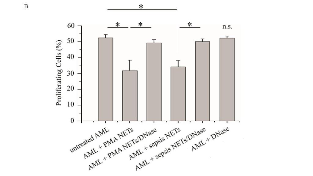 As assessed by flow cytometry, NET-treated AML cells demonstrated a remarkable reduction of their proliferation compared to untreated cells (Figures 8A-B). Figure 8.