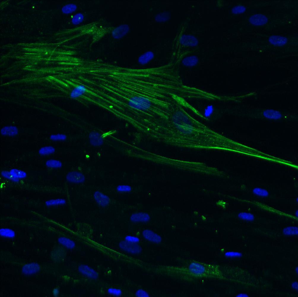 Neutrophil extracellular traps (NETs) and biomaterials: NETs are