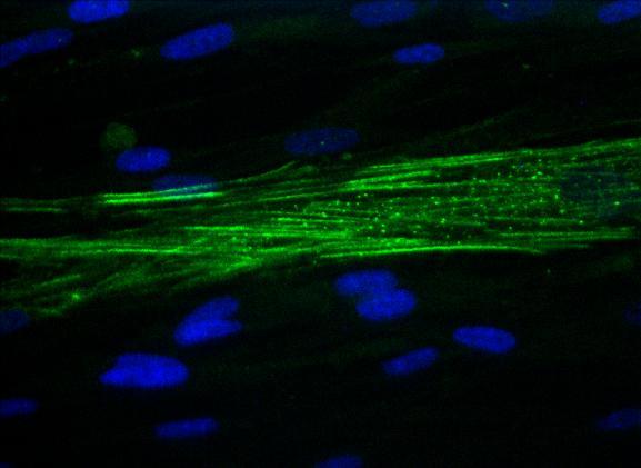 The three elements that characterize MFs are i) the stress fibers (actin microfilaments) ii) the gap junctions θαη adherens junctions and iii) the fibronexus.