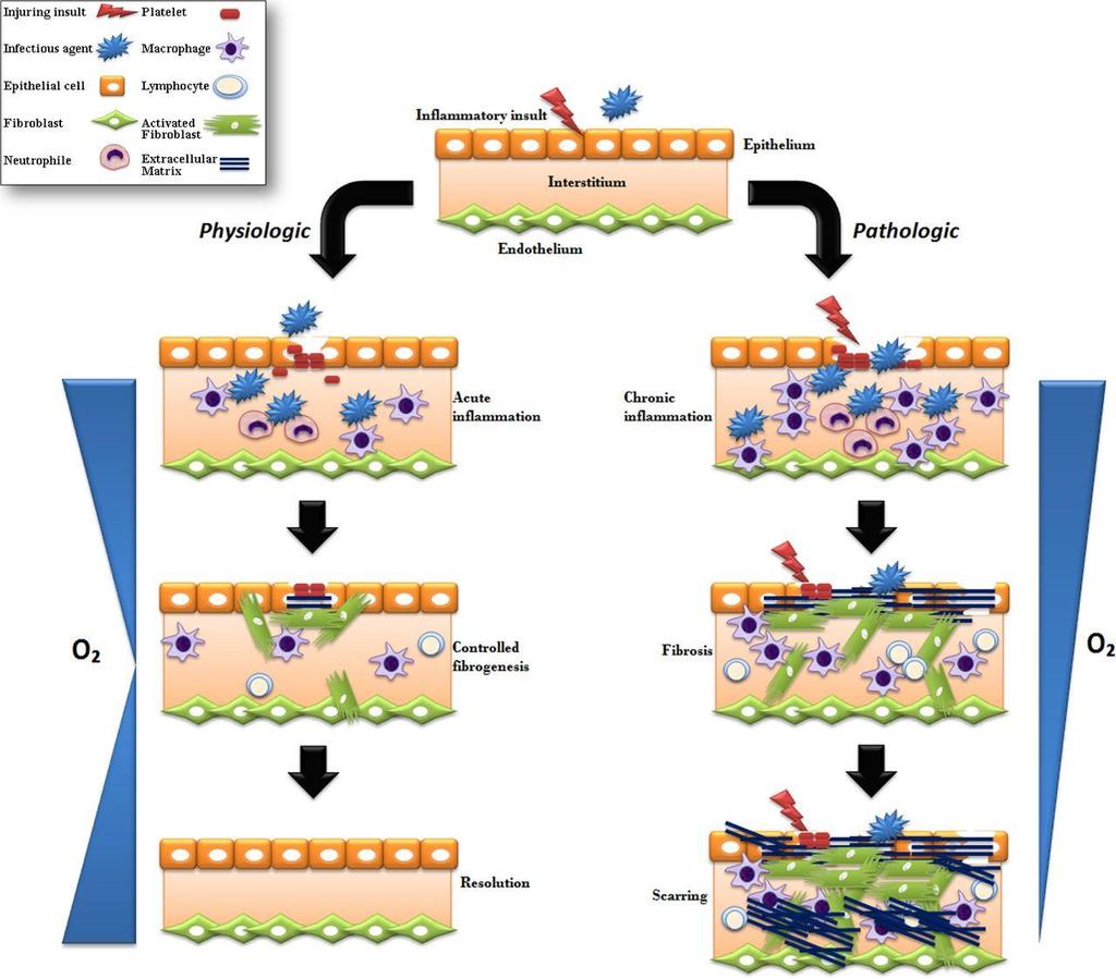 Figure 22. Normal healing and uncontrolled healing (Fibrosis). Normal healing leads to tissue restoration and normalization of O 2 delivery despite initial decrease tissue perfusion (left).
