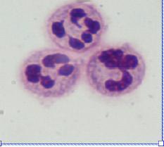 7. NEUTROPHIL EXTRACELLULAR TRAPS (NETs) Neutrophils are terminally differentiated white blood cells that have a short life in circulation.