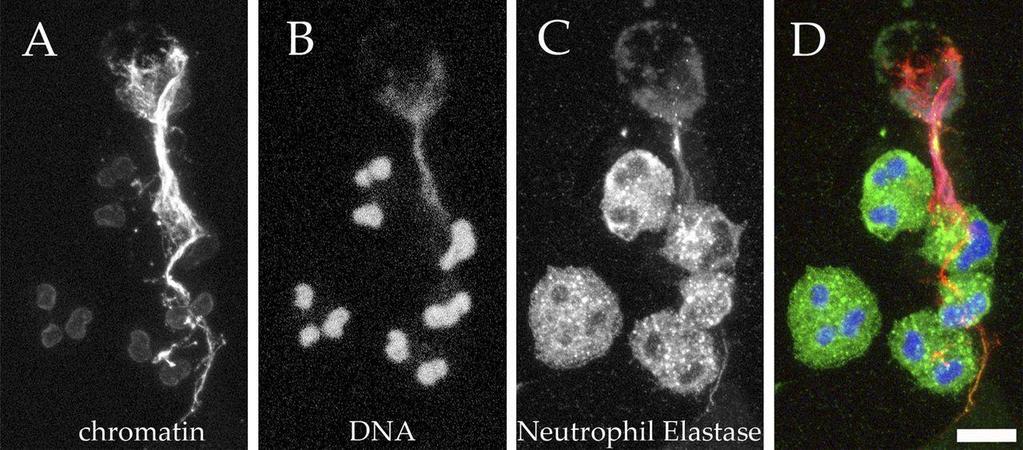 mentioned here. Computer-assisted analysis of the overlap between chromatin and neutrophil markers can quantify NETs in tissue sections.