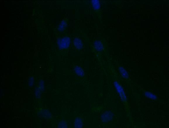 Since fibroblasts-myofibroblast transition is a key stage in fibrosis and also involved in restenosis, we first investigated whether stents were able to induce fibroblast differentiation to