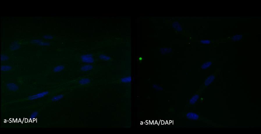 Figure 32. Stents cannot induce fibroblast (FBs) differentiation directly. FBs coincubated both with BMS and DES remained negative for a-sma staining.