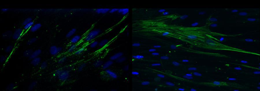 Stents-induced NETs promote fibroblast differentiation in vitro We next investigated whether both stent type-induced NETs, expressing IL-17, were able to induce fibroblast differentiation in vitro.