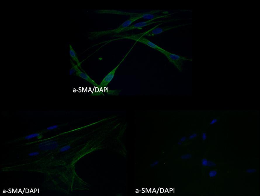 blue, a-sma: green).left: fibroblasts with BMS derived NETs. Right: fibroblasts with DES derived NETs.