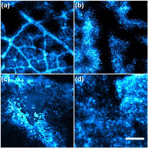 tissues Hybrid imaging of a rose