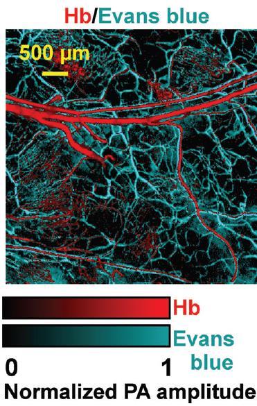 intestine (UV) OR PAM of red blood cells Mouse ear