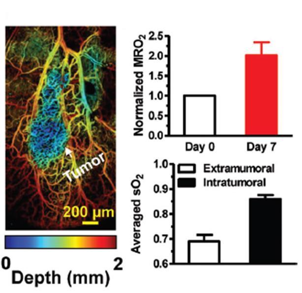 Μεταβολισμός οξυγόνου σε διαφορετικές περιοχές του όγκου In vivo μέτρηση