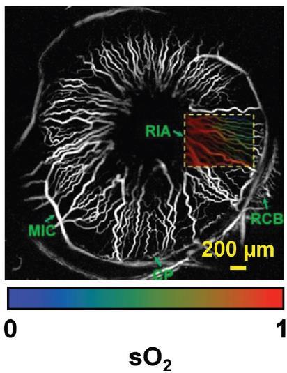 , Journal of Biomedical Optics 16(7), 076003 (2011) Επιφανειακή ανίχνευση