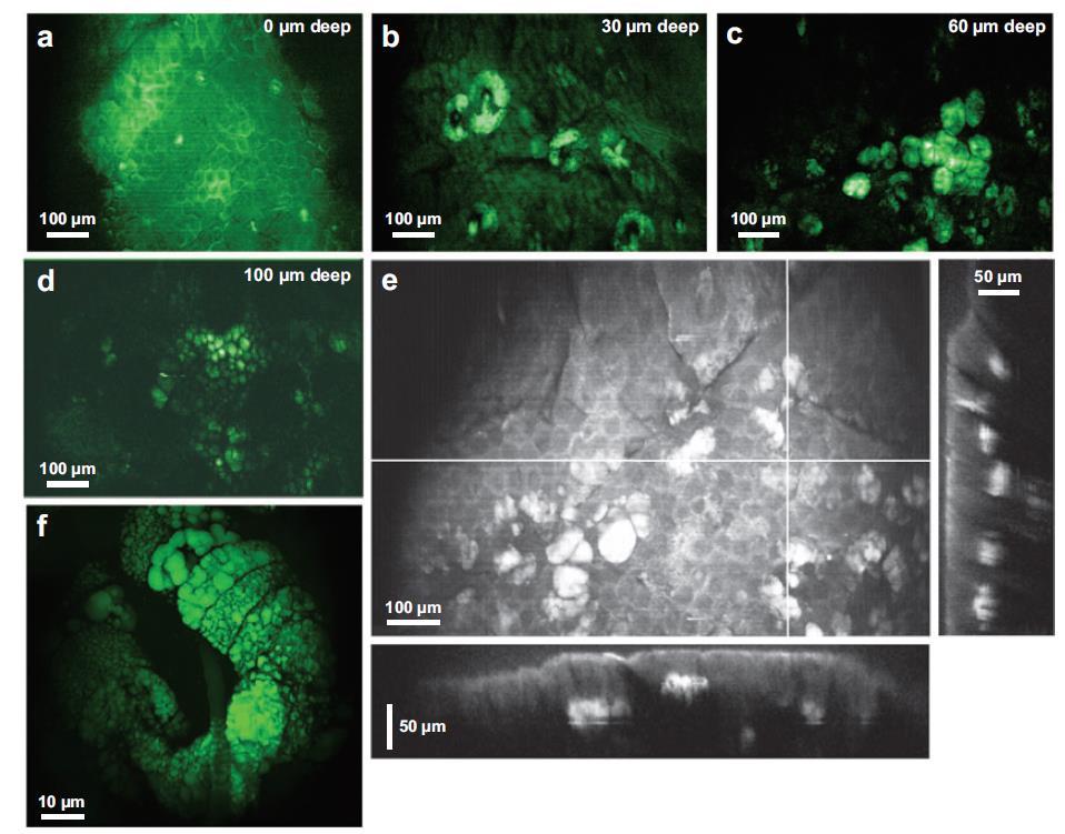 In-vivo απεικόνιση δέρματος ποντικού (lipid band) a) Σήμα από το περίγραμμα των κερατινοκυττάρων λόγω λιπιδικών στιβάδων, b) Σήμα από τους σμηγματογόνους αδένες