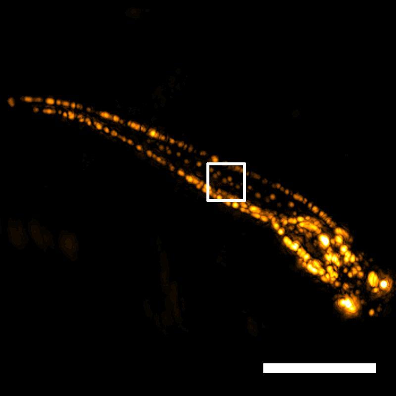 Melanocytes